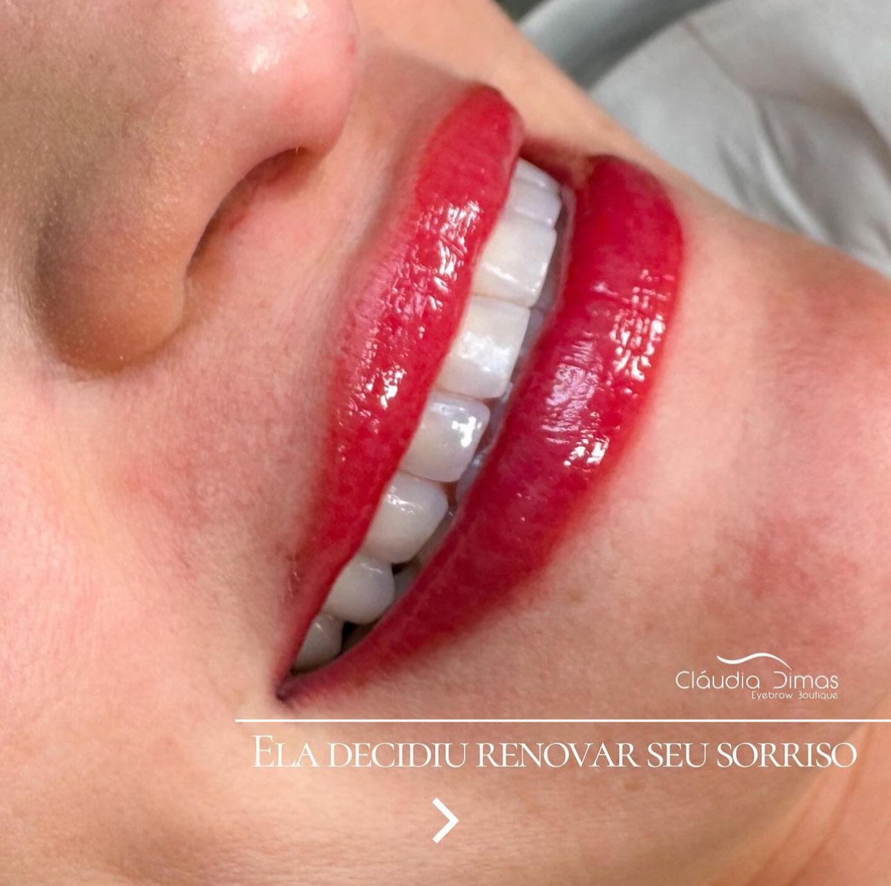 Micropigmentação labial